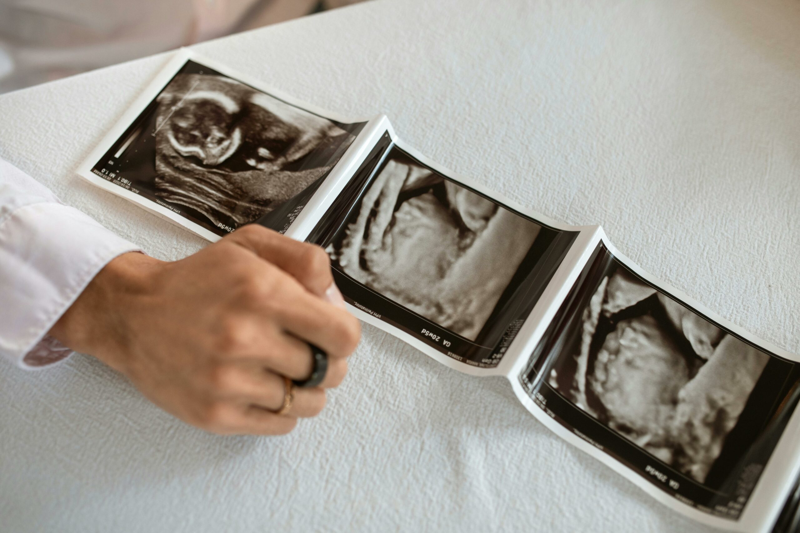 La préparation d'une chambre de bébé s'anticipe. Retrouvez tous nos conseils.